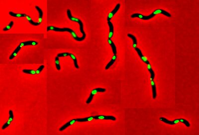 Vibrio cholerae with segregation problems