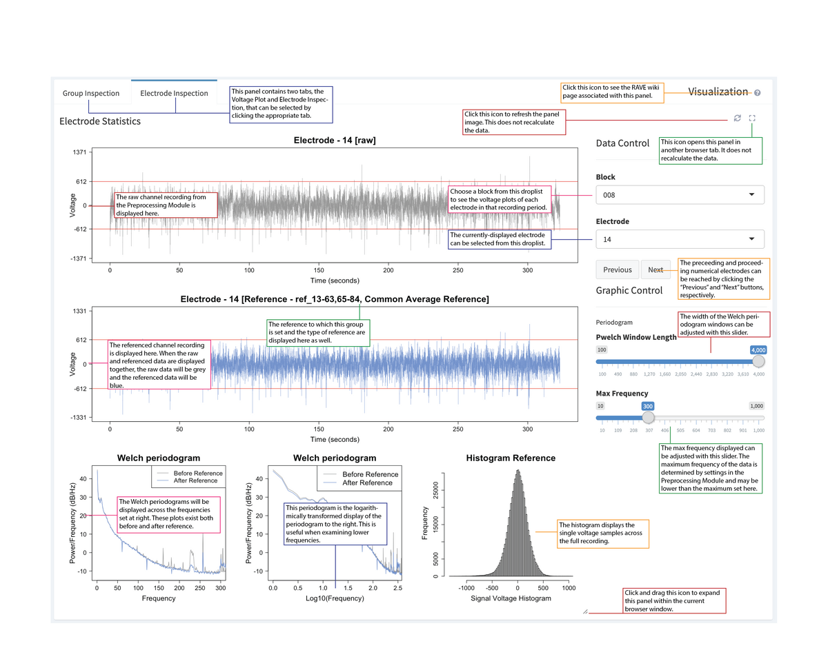 Electrode Inspection