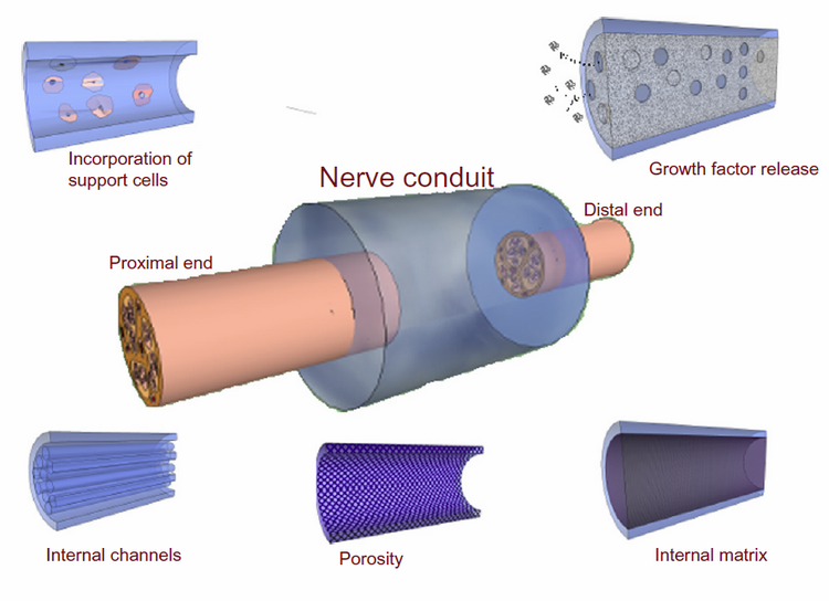 General schemes of designing artificial nerve conduits [9]