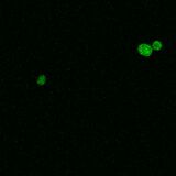 A4V SOD1, induction at 37°C