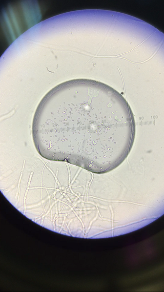 File:Lynda Arostegui before gram.png