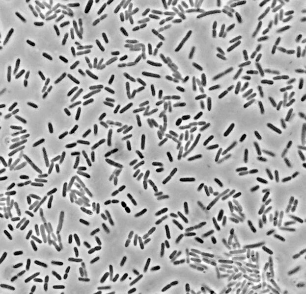 File:E coli Top10 original.jpg