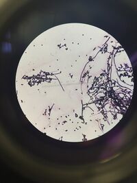 Picture of 10^(-9) tet. The cell includes both coccus (small sized circular cells) and filamentous (elongated string that are tied together. Measures 2µm at 40X magnification for coccus, and 20µm to 100µm at 40X magnification