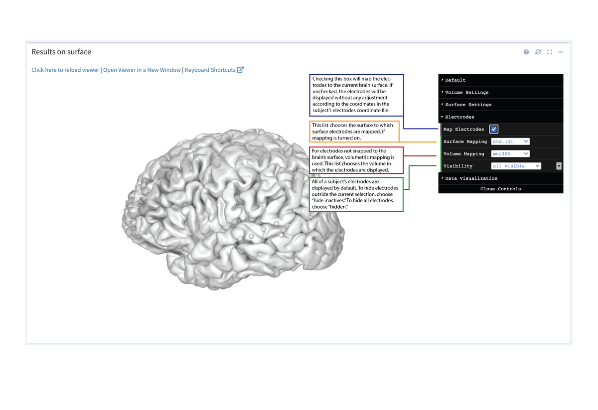 3D Viewer Electrodes Settings