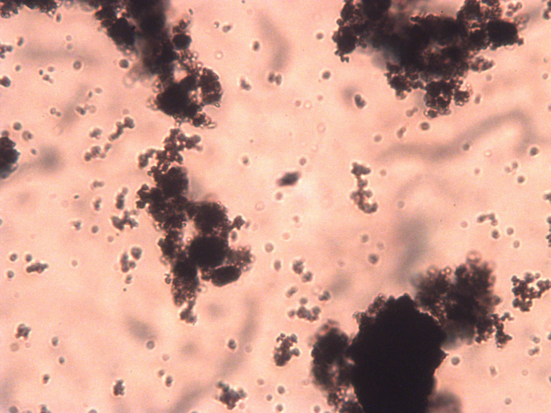 File:1.6uM heme 32x.jpeg