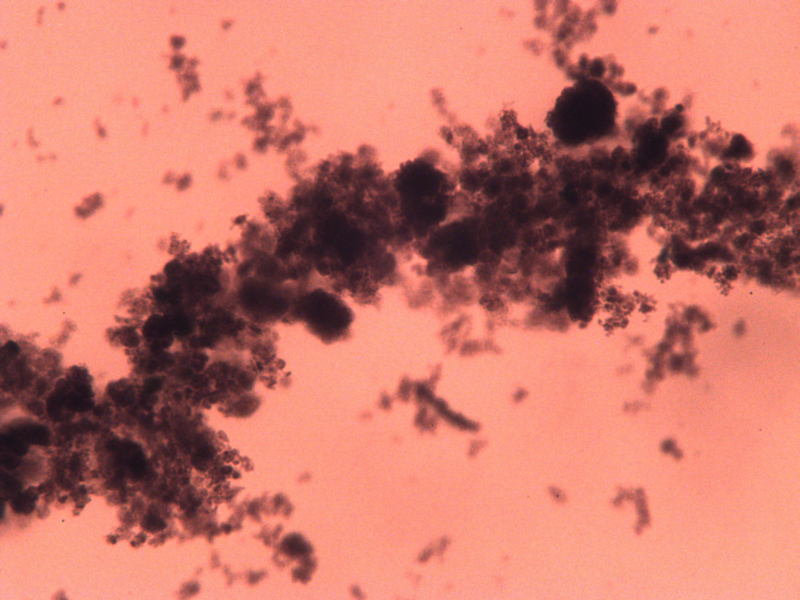 File:CoMicrogel-1 1 10Xa.bmp