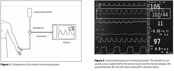 Invasive monitoring procedure