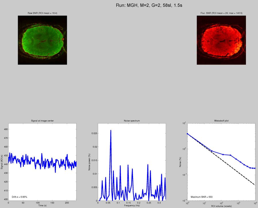 MGH Blipped CAIPI multi-band EPI with SMS 2, GRAPPA 2, TR = 1.5 seconds