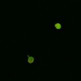 A4V SOD1, induction with 1:4 paromomycin dilution (3.5 mM)