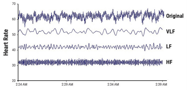 Description of image