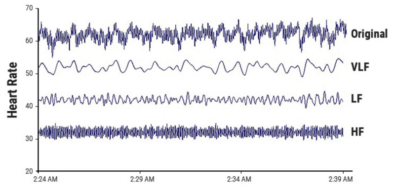 File:Heart Rate HRV.png