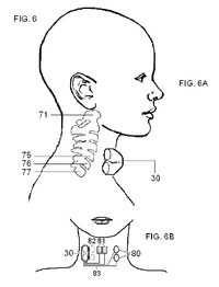 Non-invasive VNS Drawing
