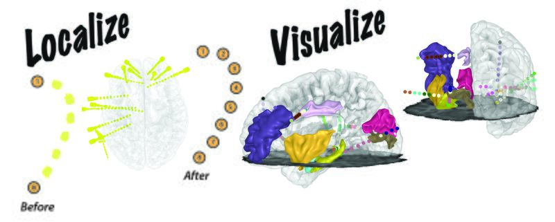 File:YAEL GraphicalAbstract.jpg