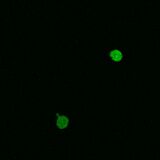 A4V SOD1, induction with 1:4 paromomycin dilution (3.5 mM)