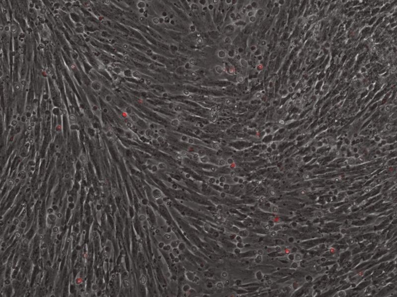 File:2015-02-02 Well 3 phase mCherry 10x.jpg