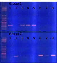 Gel electrophoresis