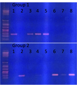Gel electrophoresis
