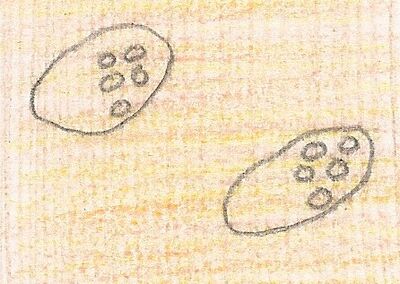 Illustration of Two Colpidium