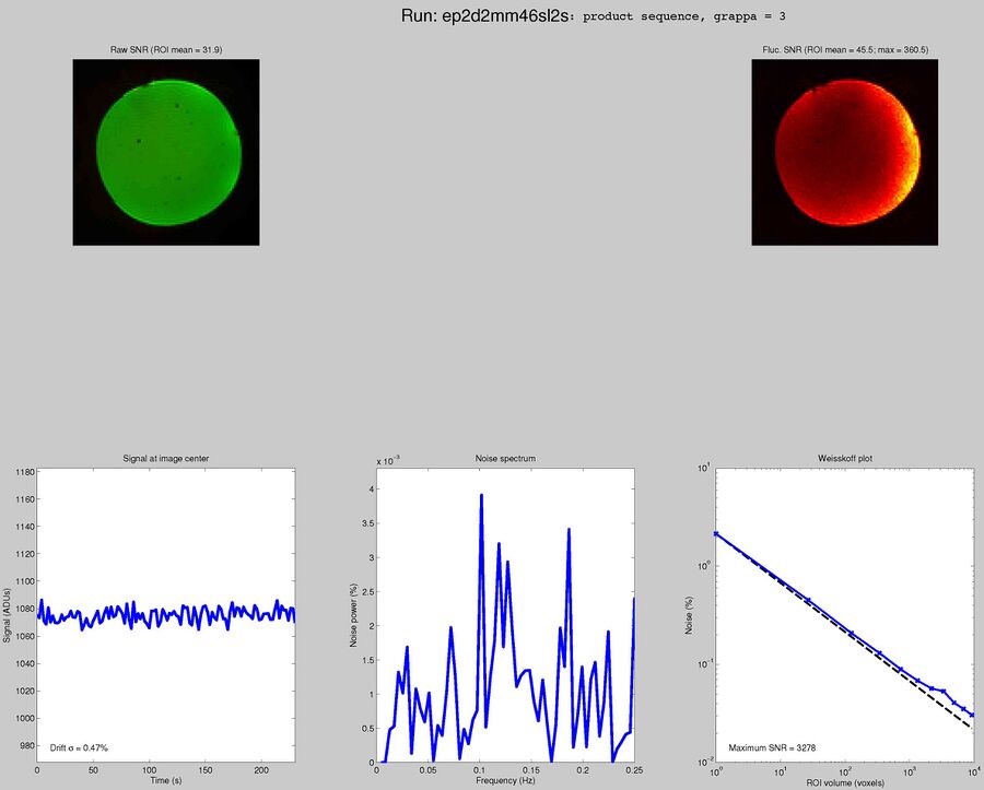 Siemens EPI product sequence with GRAPPA 3, TR = 2 seconds