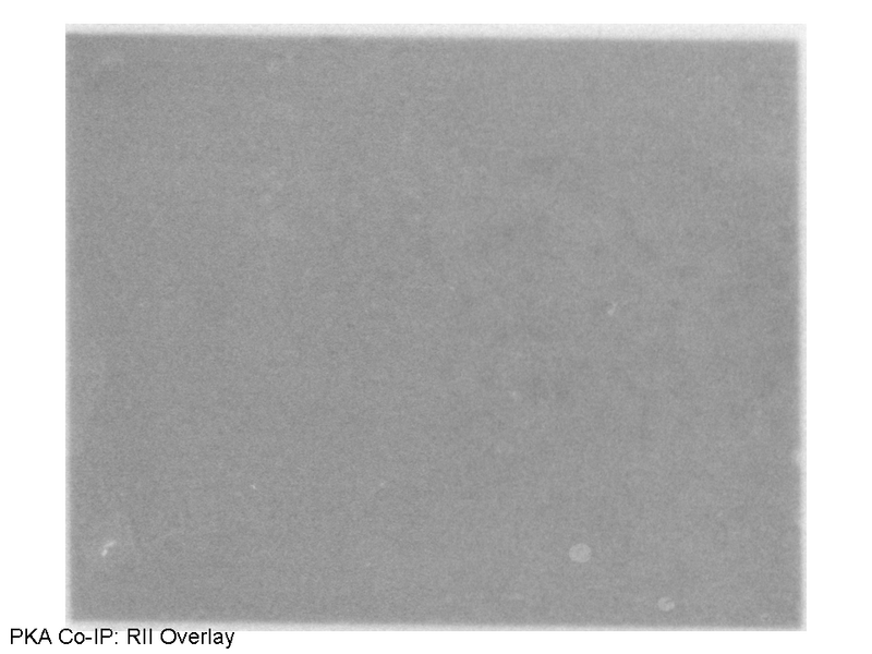 File:25082010 RII Overlay PKA Co-IP.TIF