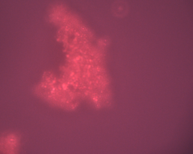 File:20110810-01 BSA-AuNP aggregate from Abigail 50x.jpg