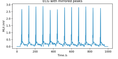 Figure 2.5c: Previous ECG with Mirrored Peaks