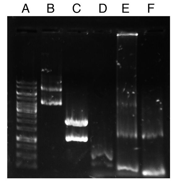 File:Colony PCR check Chloe.jpg