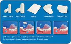 Various commercially available collagen-based dental implants