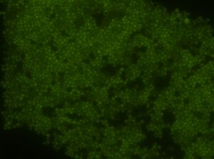Raw Data of Yeast at 16 hours
