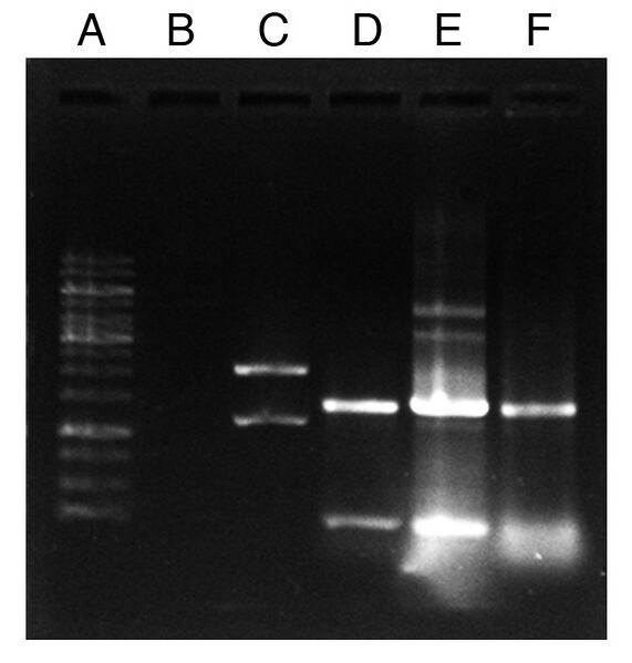 File:Colony PCR check Jesslyn.jpg