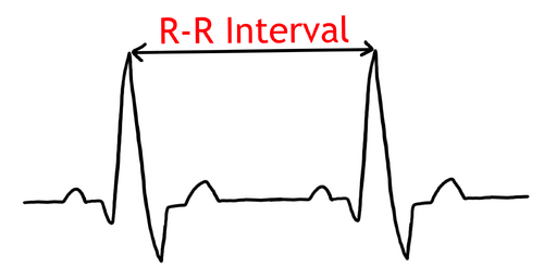RR Interval