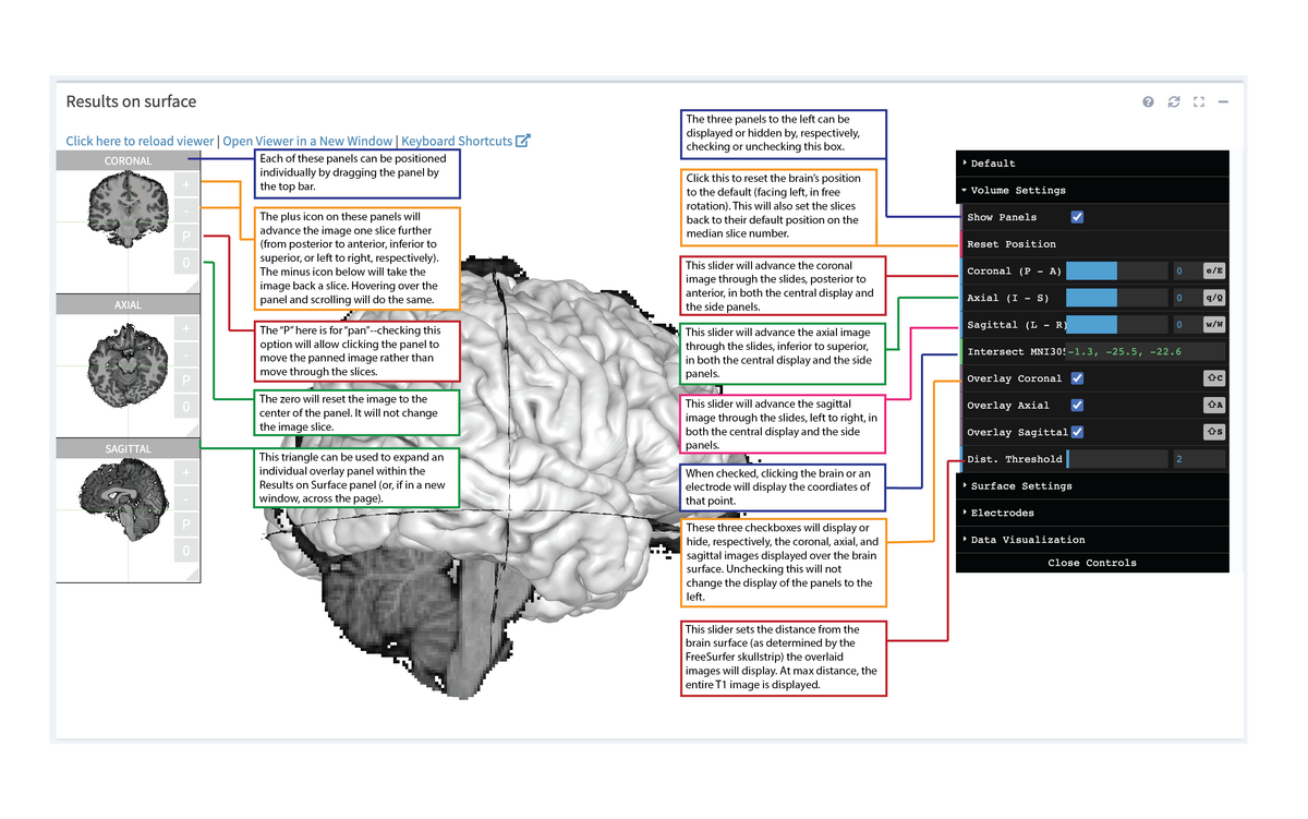 3D Viewer Volume Settings