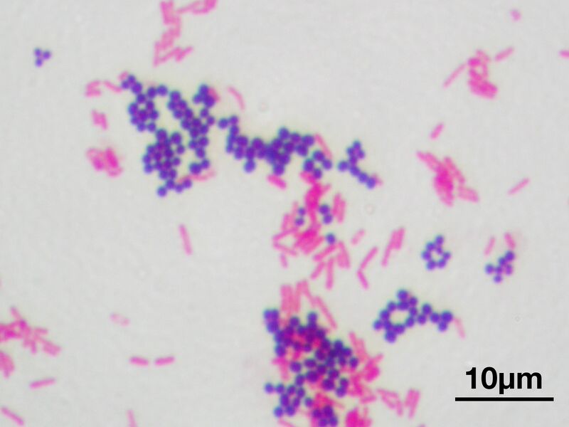 File:Gram stain 01.jpg