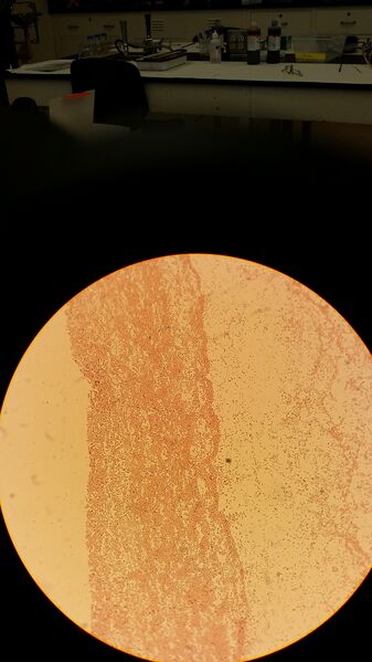 File:Gram negative 10^-3 yellow with TET.jpg