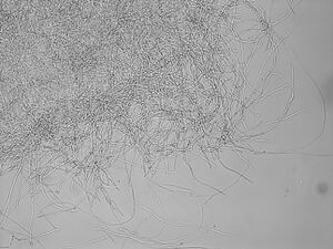 Micrograph of G. lucidum hyphae.