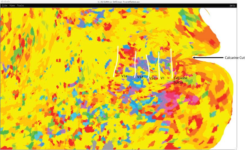 File:CaretRetinotopy.jpg