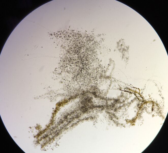 File:Oedogonium top.JPG