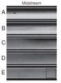 Figure 7. Two methods of printing were used, resulting in both inked surfaces of BSA underneath the cantilevers and solely around the cantilevers. (1) Inking the stamp with IgG. (2) Washing and drying the stamp. (3) Cleaning outside the stamp grooves. (3B) Inking the stamp with BSA. (4) Printing after aligning the stamp and the chip. (4A) Incubating the chip with BSA. (5) Result.