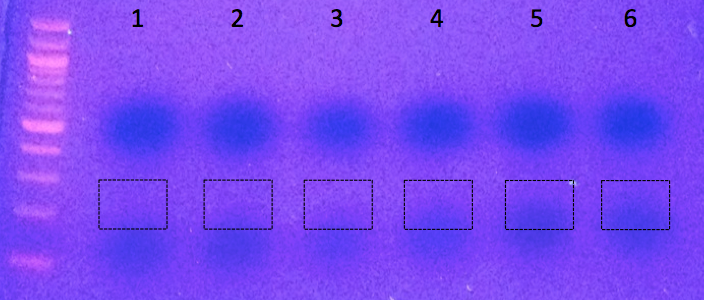 File:KAH121411 gel1.tif