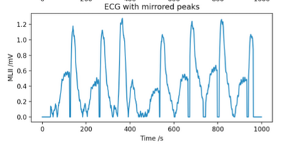 Figure 2.5g: Previous ECG with Mirrored Peaks