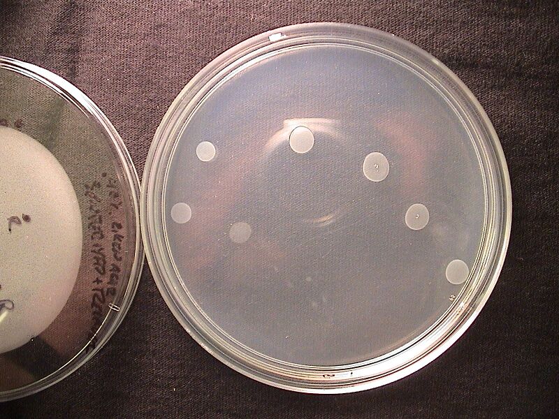 File:40EikenAgar YFPSender+Receiver 8hours.JPG