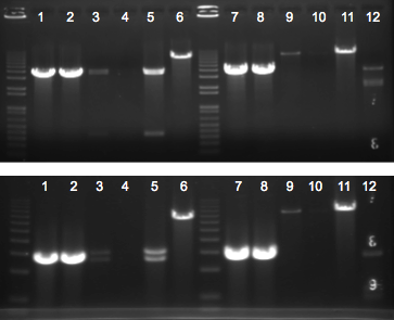 File:KAH 012610 gel1.tif