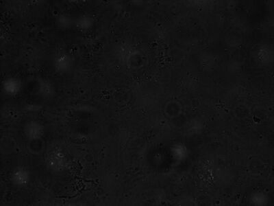 Representative FITC micrograph image of transformed protoplasts after 4 hours of incubation, 20x magnification.