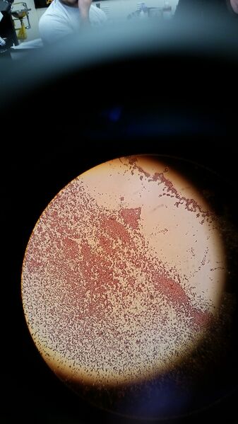 File:Gram negative 10^-3 non-TET.jpg