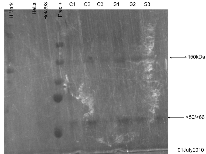 File:01072010 cAMP precipitation Coomassie.png