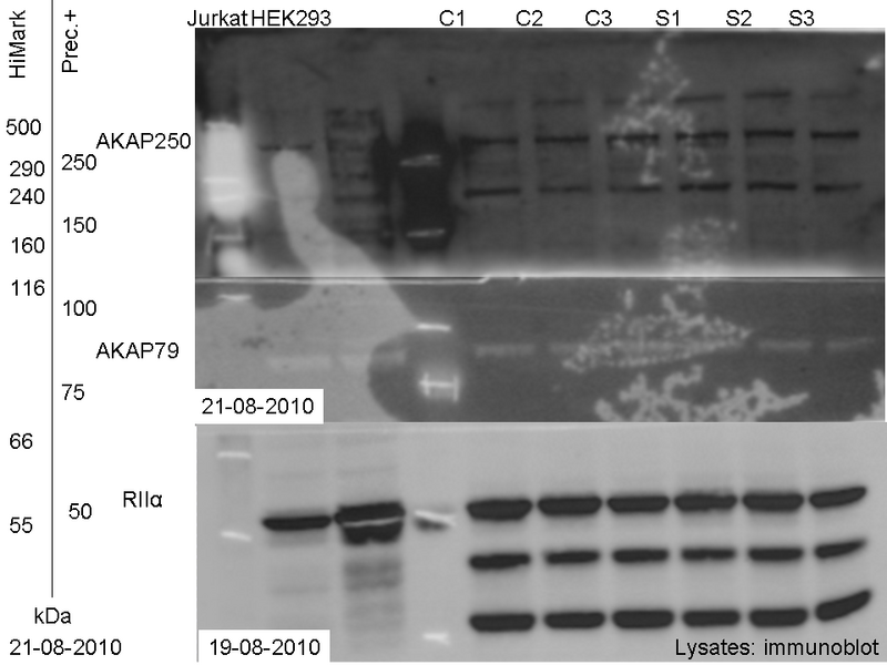 File:21082010 Lysates Immunoblot AKAP250 and 79.tif