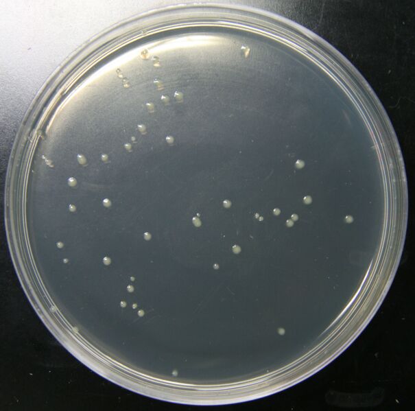 File:TetRpromoter GFP limon.jpg