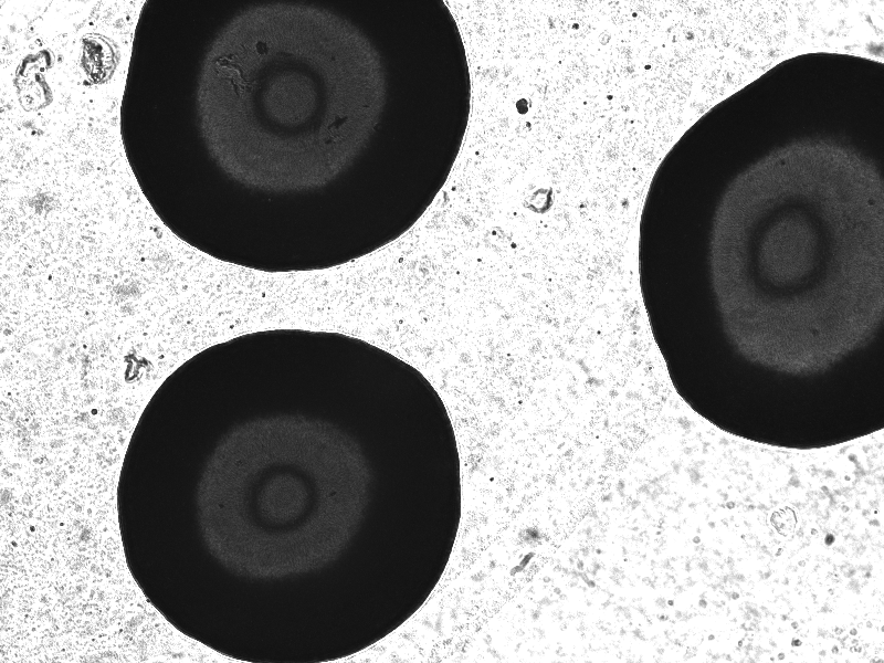 File:Coli-P3 electrocomp.tif