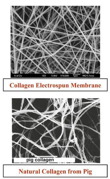 File:Helen Collagen.png