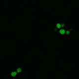 WT SOD1, induction with 1:4 paromomycin dilution (3.5 mM)
